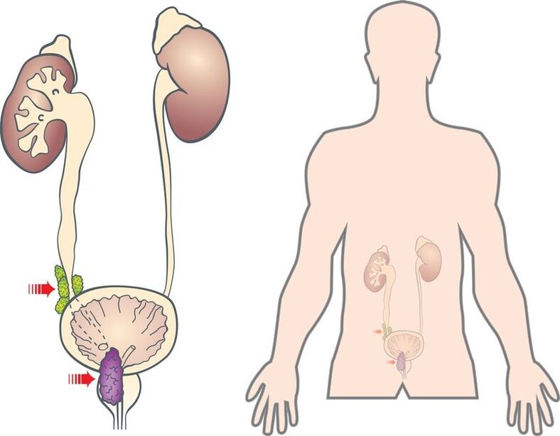 prostat adenomunun belirtileri ve nedenleri